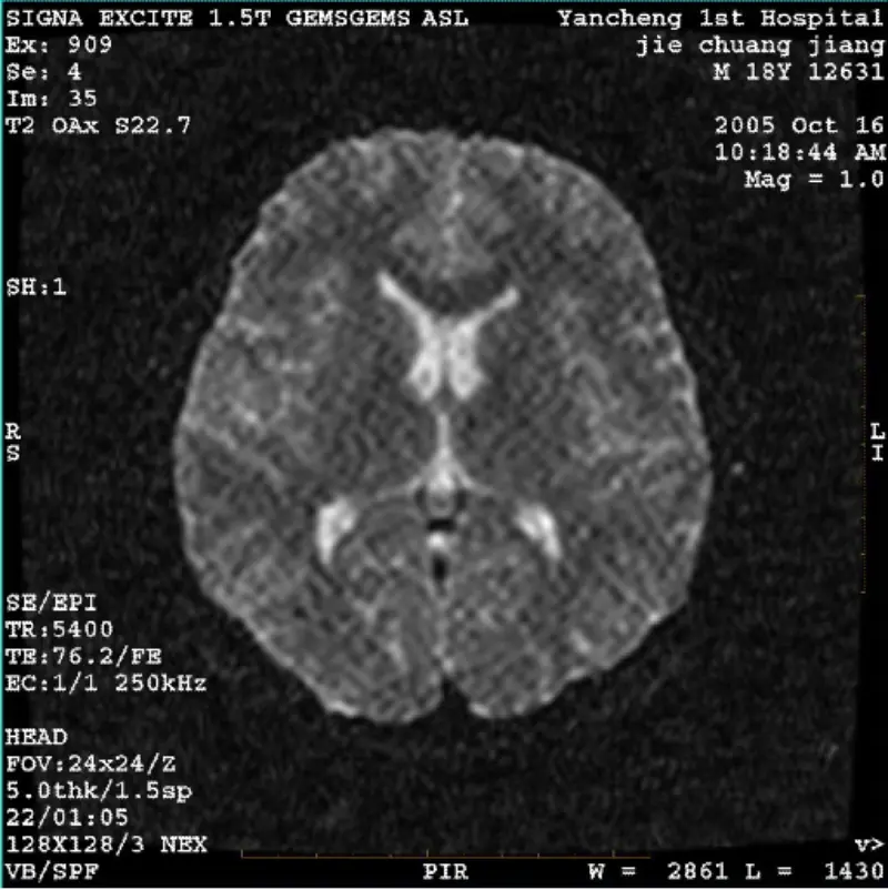 ARTEFACTO WI/Fiesta Imagen Píxel blanco